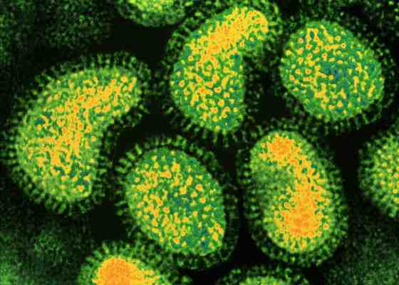 Influenza A virus