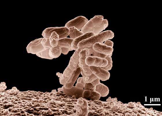 E coli