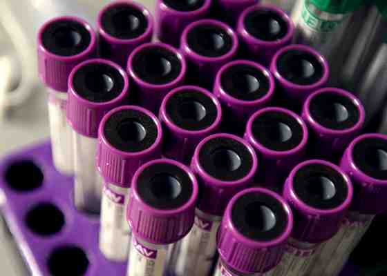 Blood test tubes