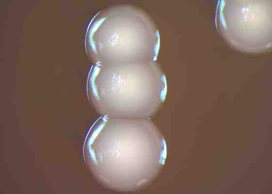 A bacterial culture of Elizabethkingia anophelis